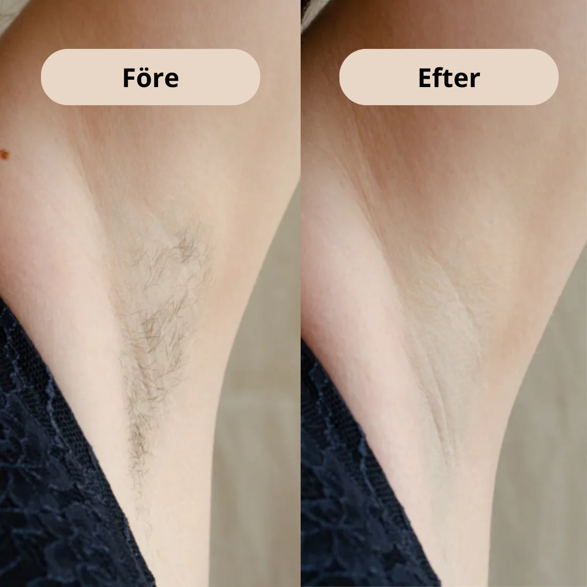 Luxe Shave - Skonsam rakning för kvinnor